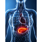 Bekam Diabetes