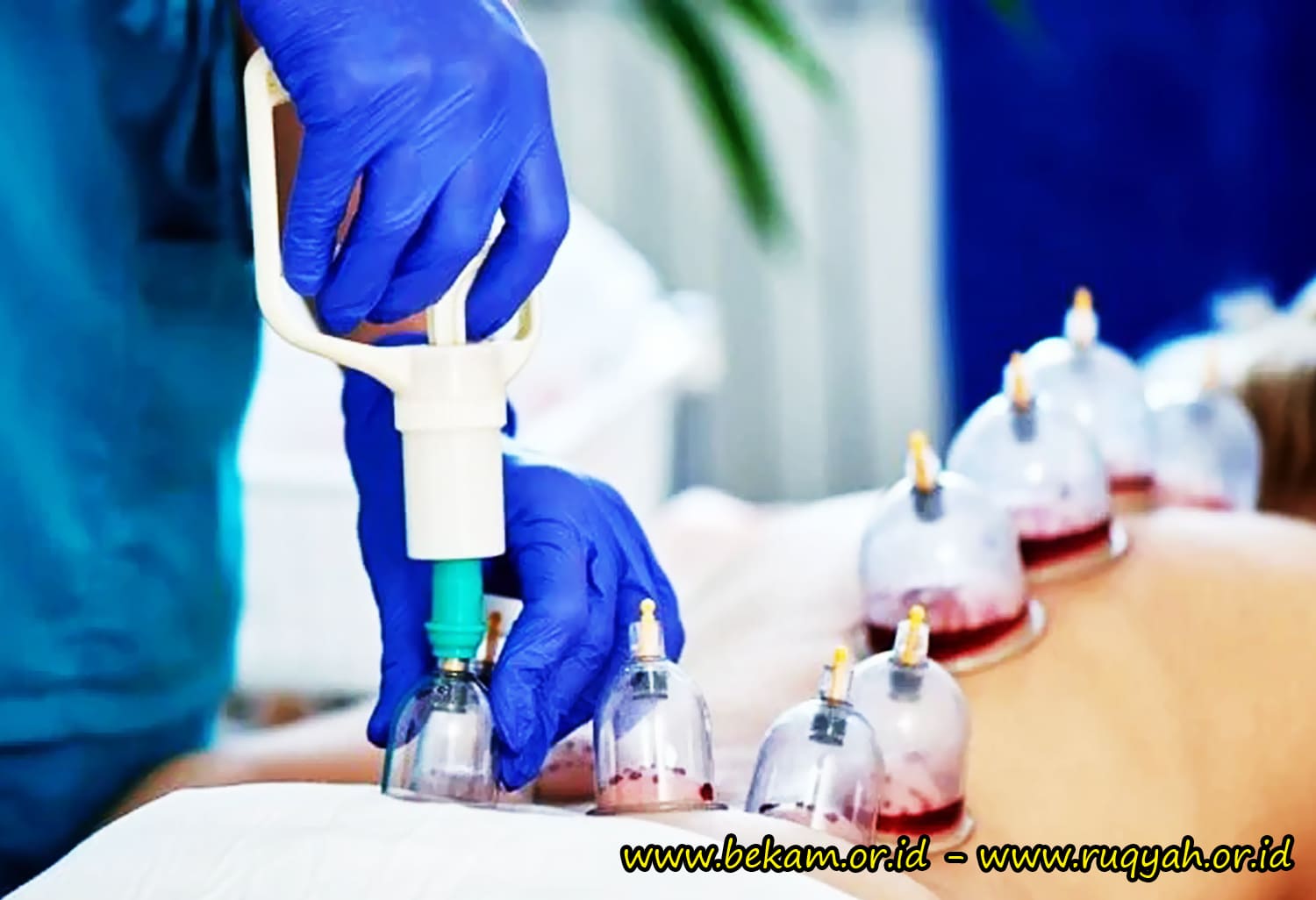 Bekam Batam Ruqyah Batam Bengkel Manusia Indonesia Yayasan An Nubuwwah Indonesia