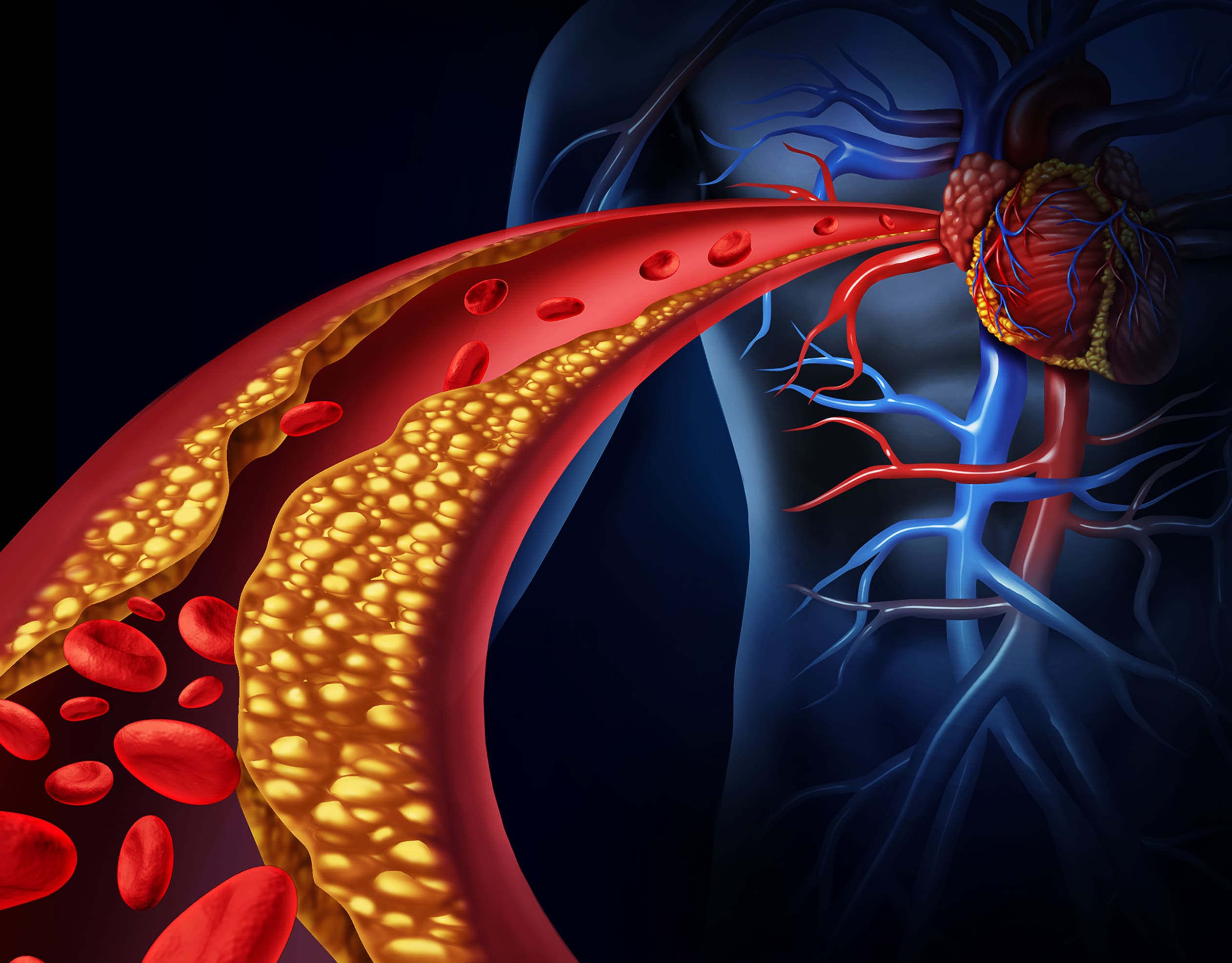 Bekam Sakit Jantung Bekam Batam Bengkel Manusia Indonesia 