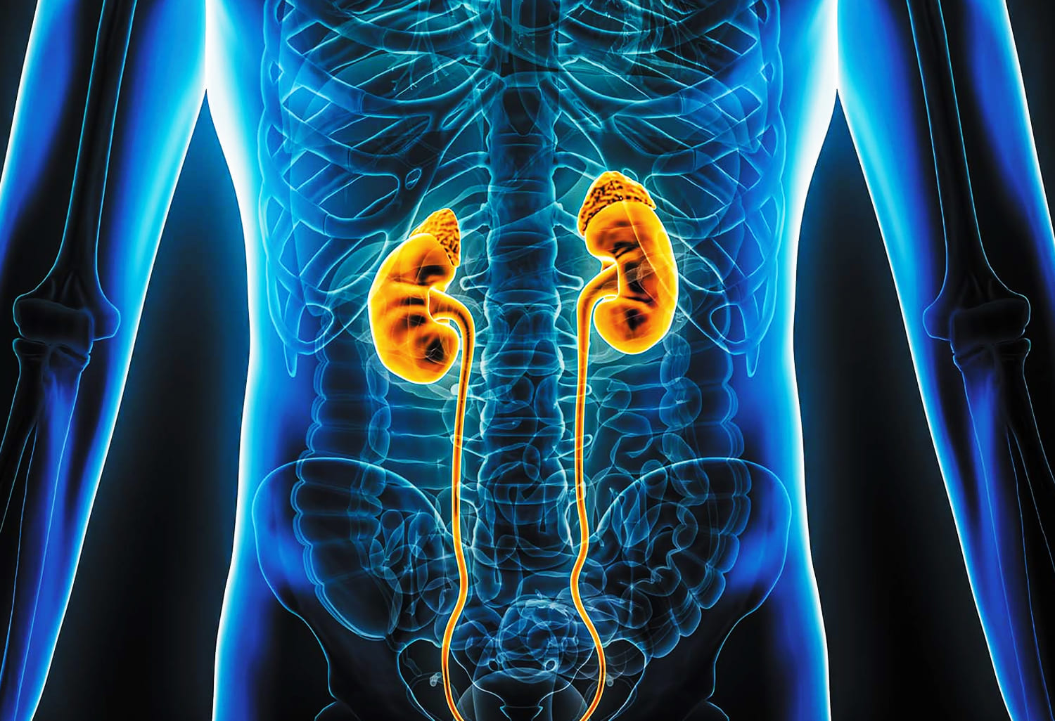 Bekam Khusus Pengobatan Ginjal