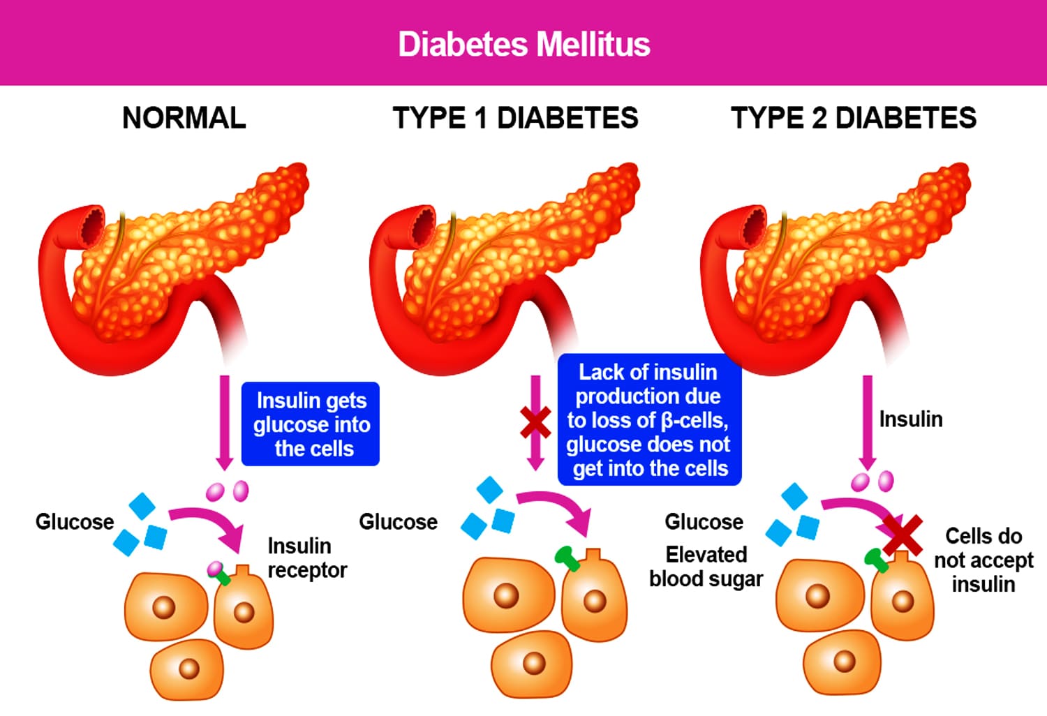 Bekam Khusus Pengobatan Pre Diabetes 1 dan 2