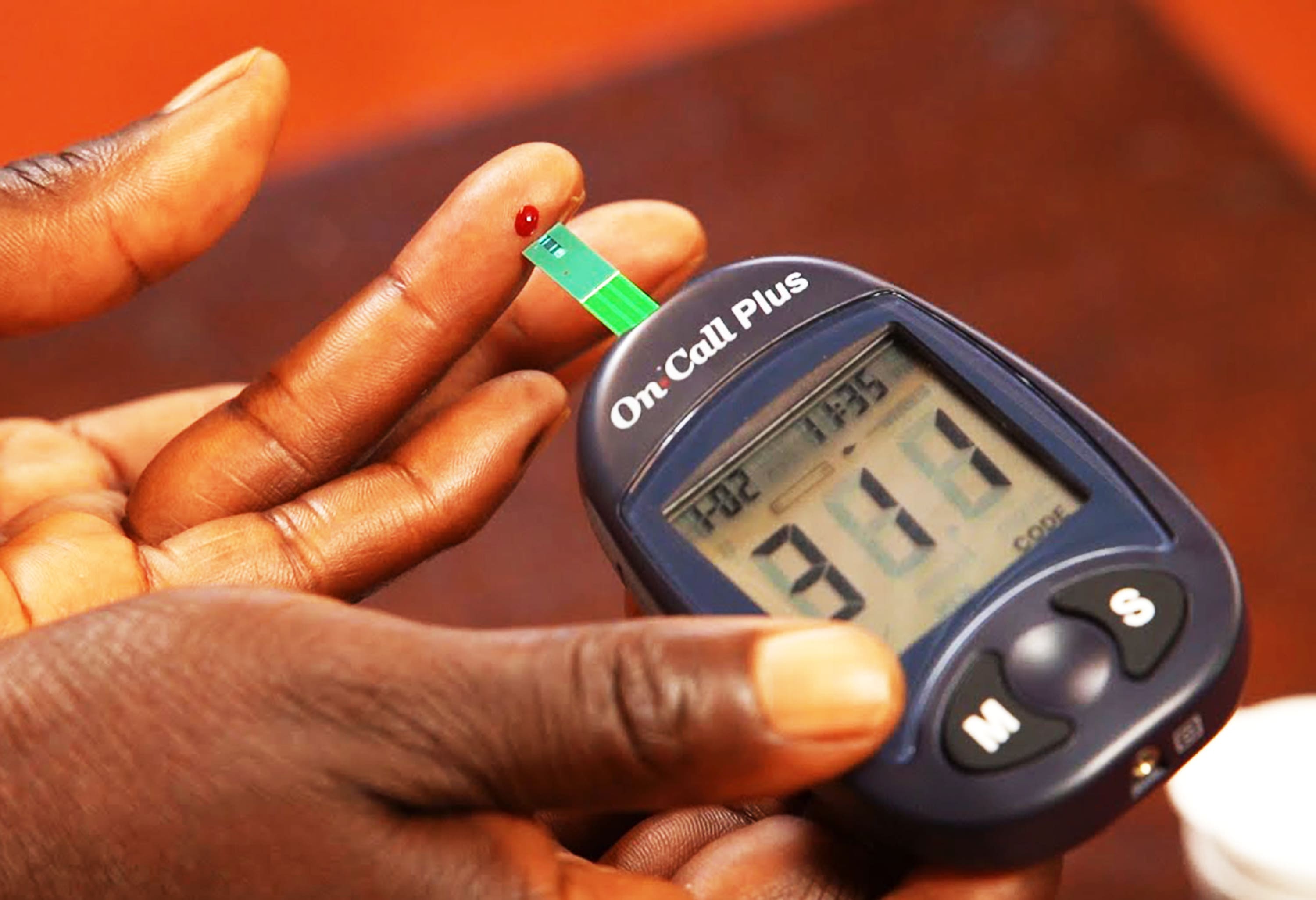 Kadar Gula Darah Tinggi Sebabkan Kerusakan Saraf