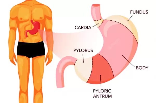 Bekam sembuhkan asam lambung