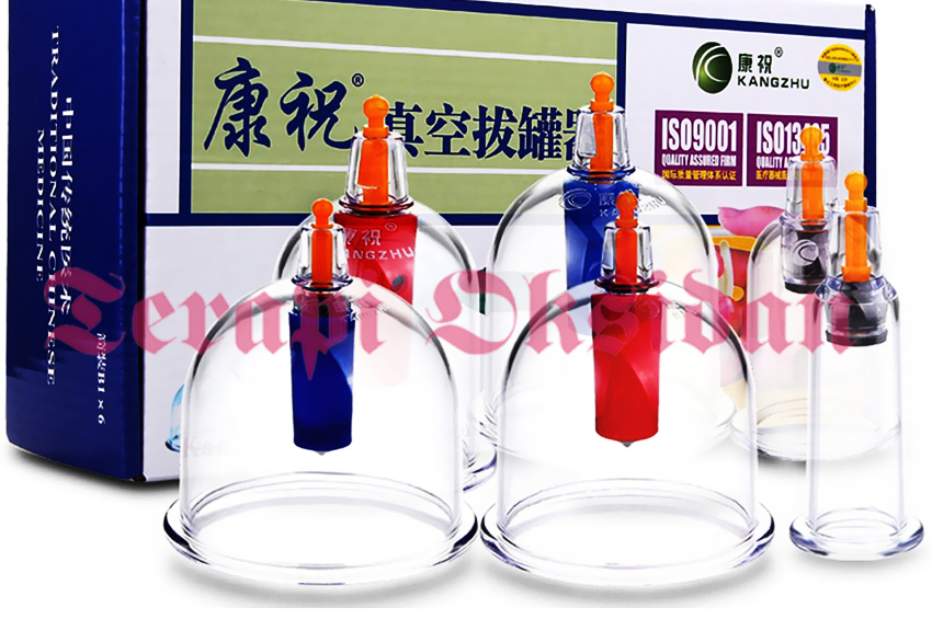 Hijama, A Forgotten Source of Barakah