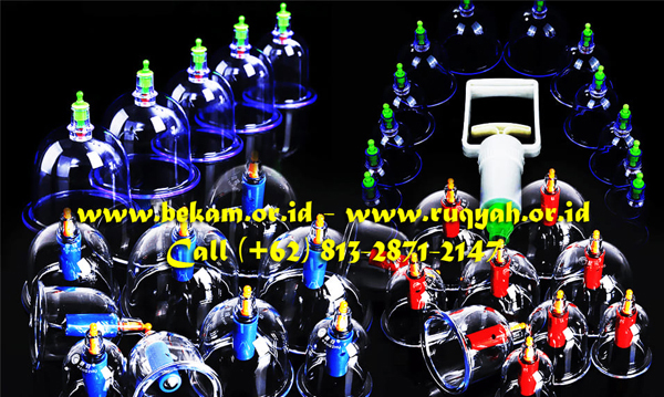 Bekam Ada Sejak Ribuan Tahun Silam