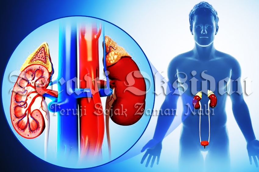 Cara Melawan Radikal Bebas dengan Bekam