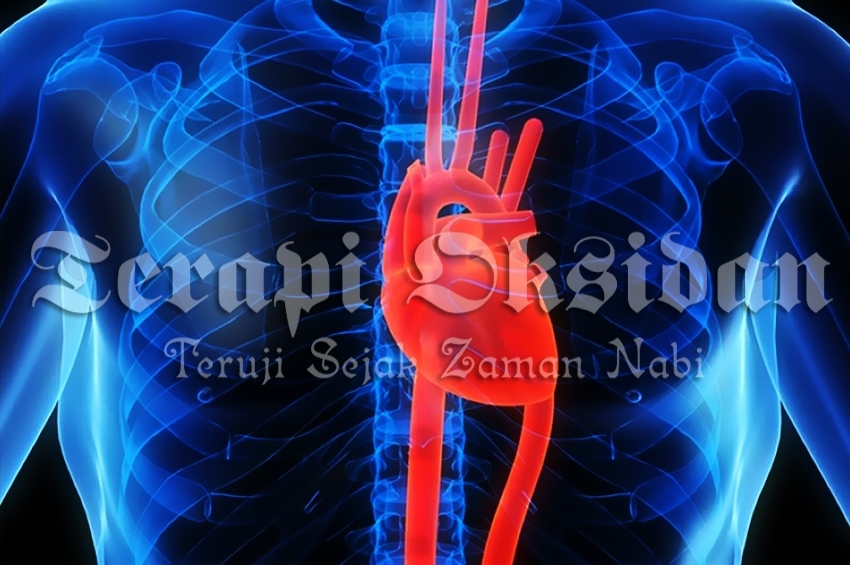 Harus Bekam Sebulan Sekali Agar Sehat