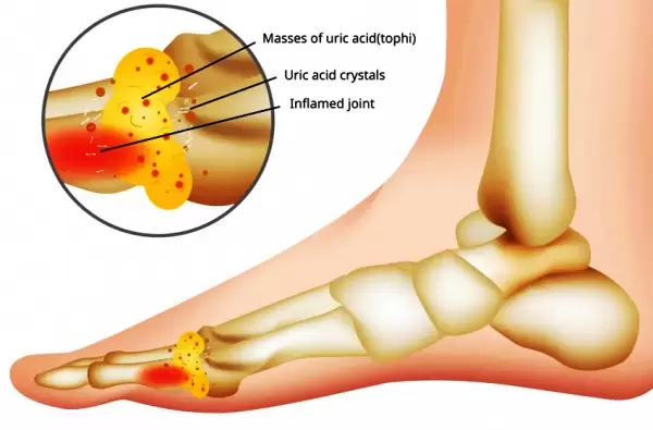 Candra P. Pusponegoro memberikan tausiah bekam di Masjid Agung Batam (Masjid Raya) Center