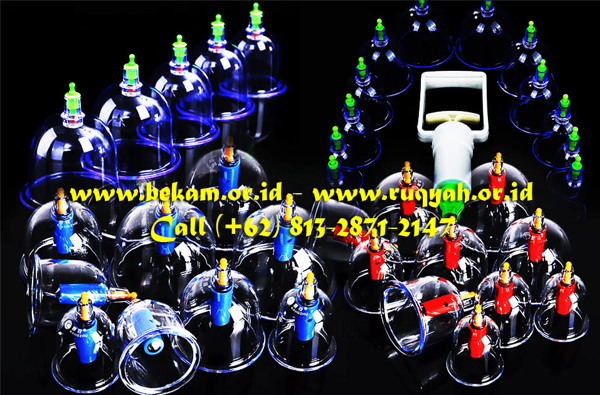 Banyak sekali manfaat bekam untuk kesehatan tubuh manusia