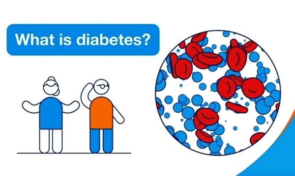 Alhamdulillah Mata Saya Tidak Jadi Buta